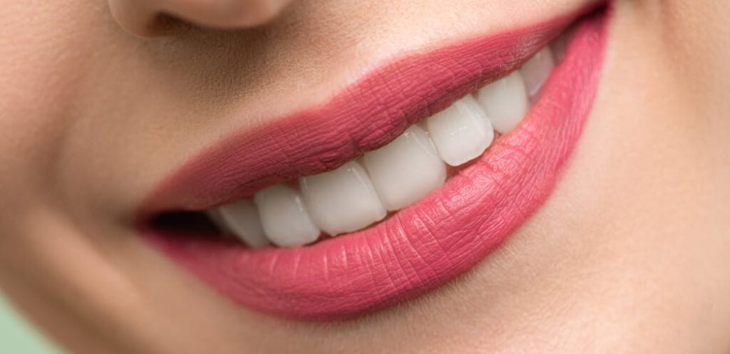 Vivid close-up image of a woman's smile showcasing red lipstick and white teeth on a light background.